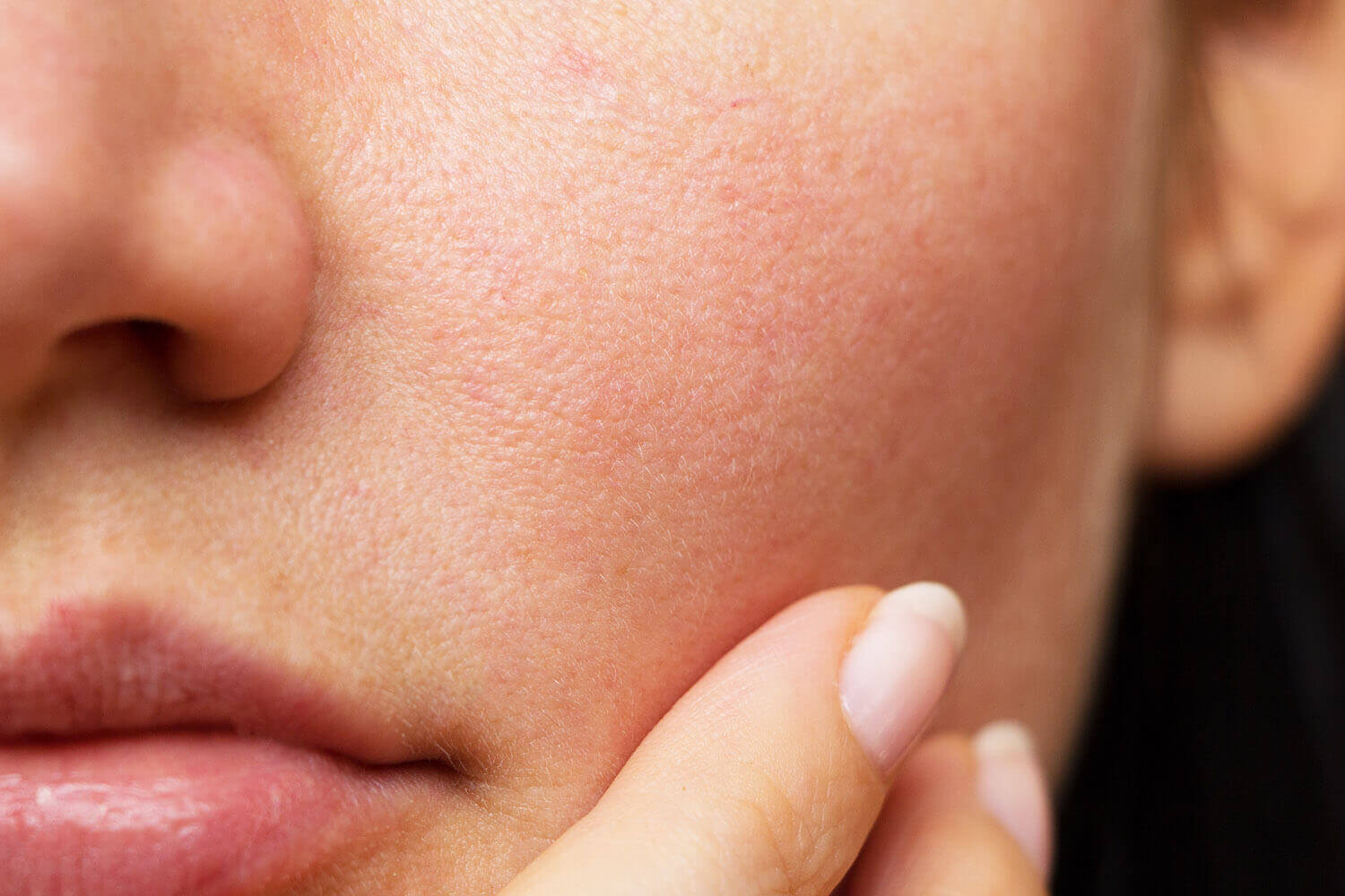How to make your pores smaller